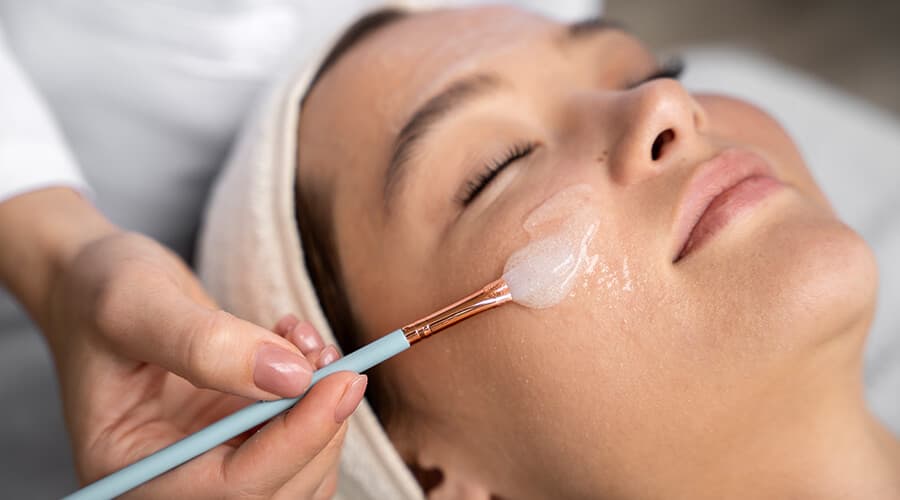 Aplicación de peeling químico